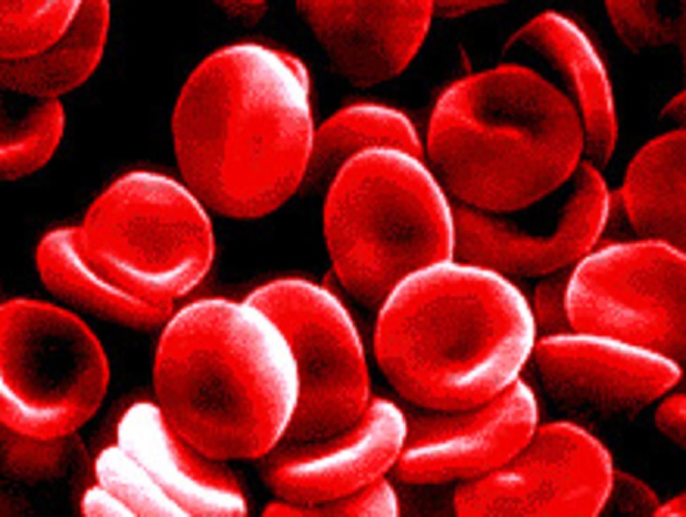 Blood Transfusion HIV Judgment